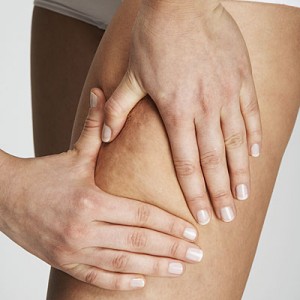 fight-cellulite-naturally